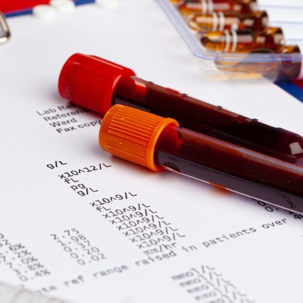 Coronavirus diagnostic and treatment concept. Laboratory table close up